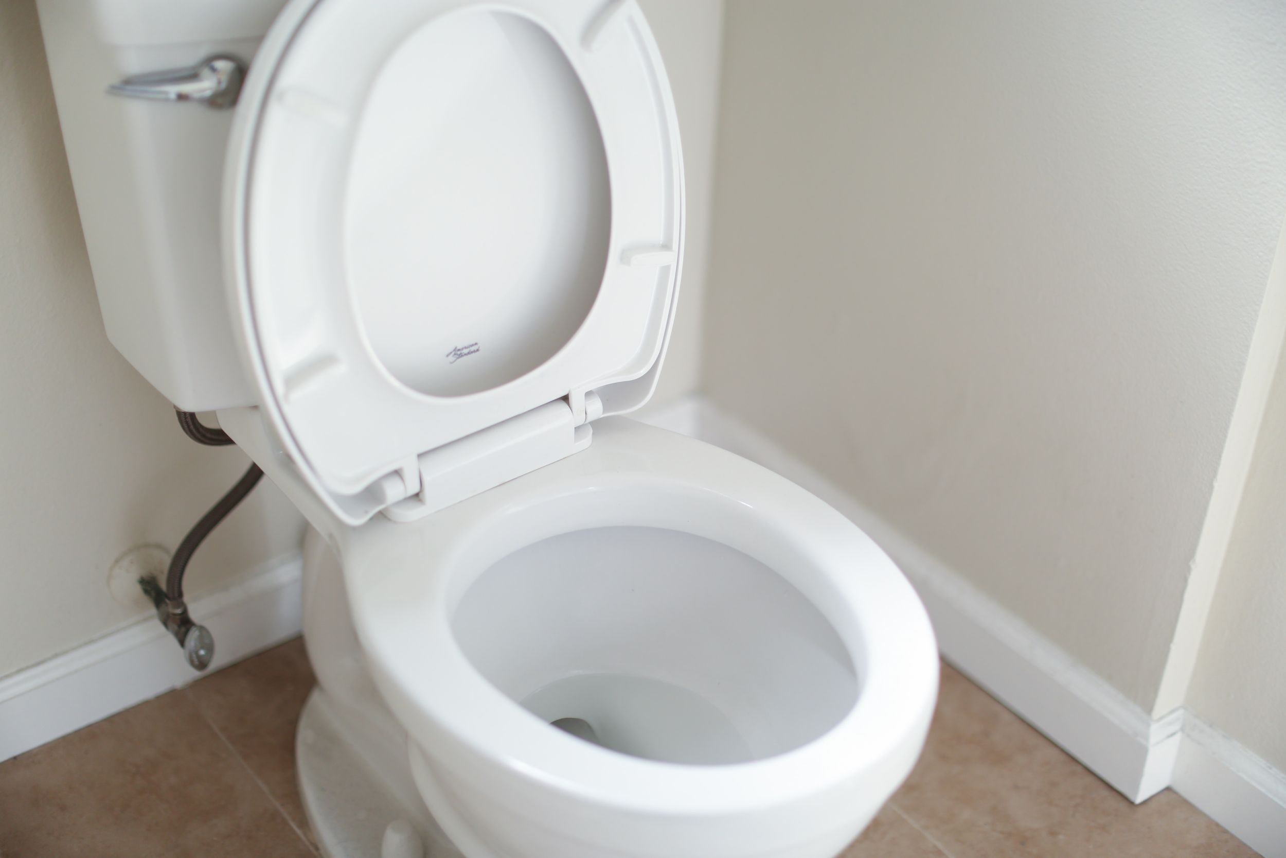 A photo of a toilet