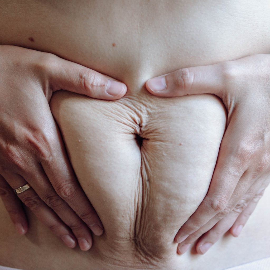 Woman holding a postpartum belly