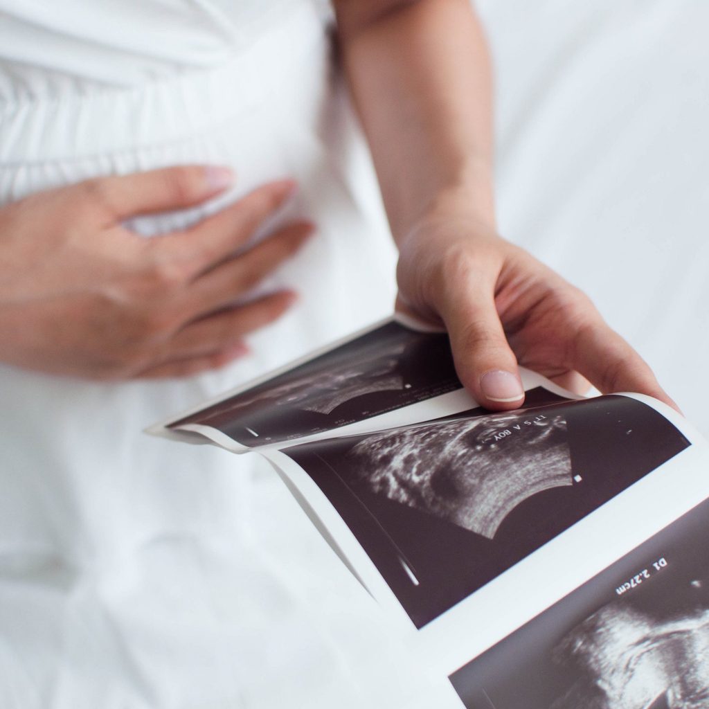 Pregnant woman at doctor's office looking at an ultrasound