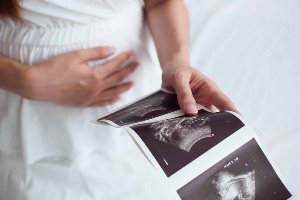 Pregnant woman at doctor's office looking at an ultrasound