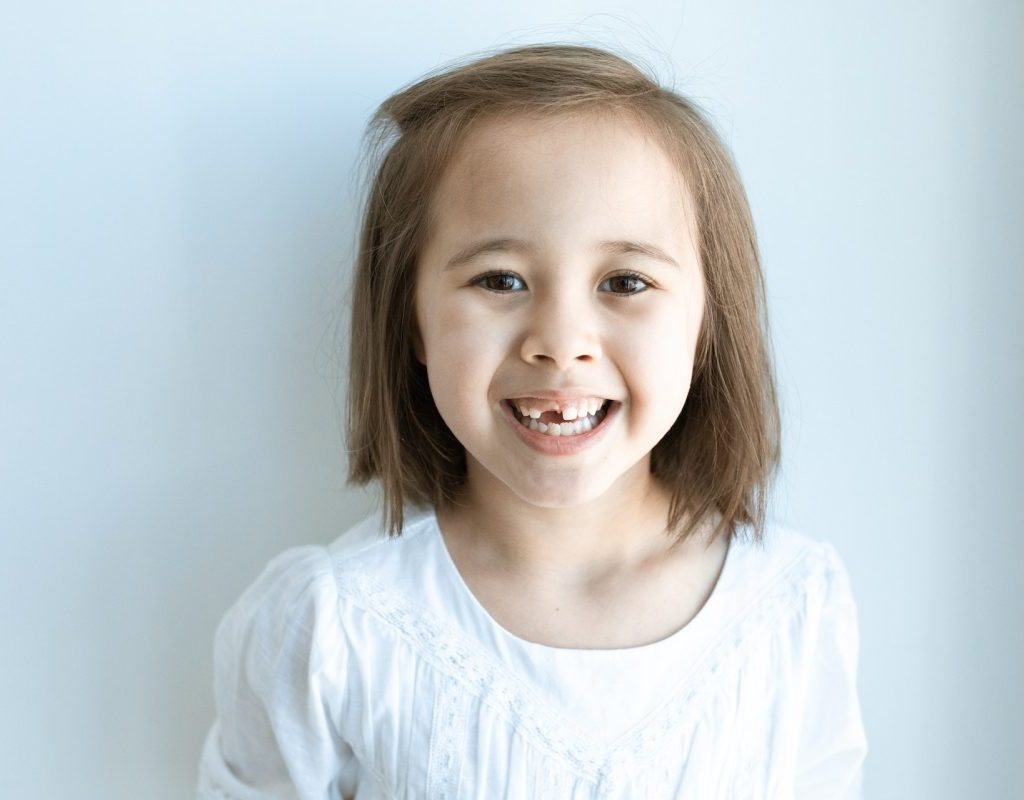 A child smiling, revealing that they are missing a tooth.