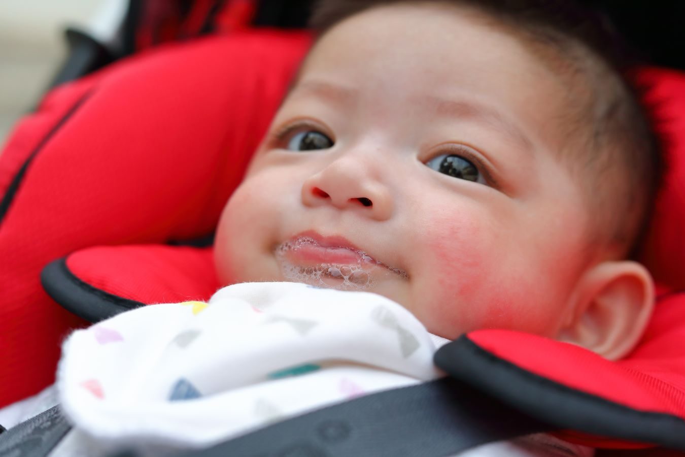 Smiling baby with drool rash