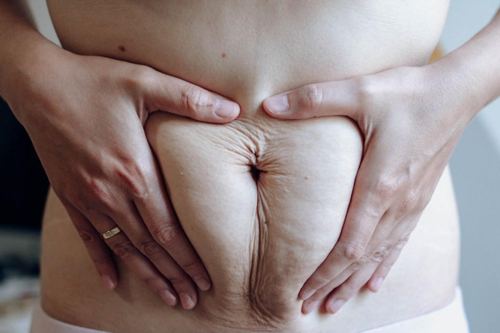 Woman holding a postpartum belly
