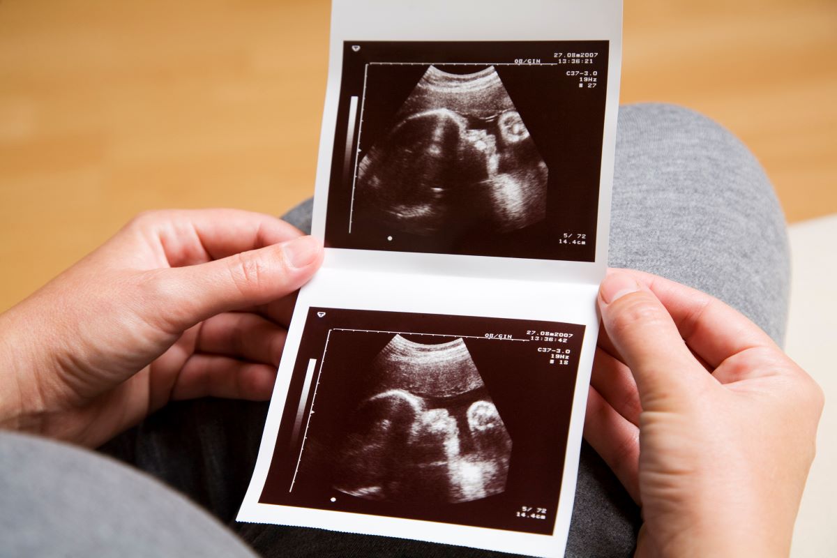 A lady's hands holding two sonogram pictures