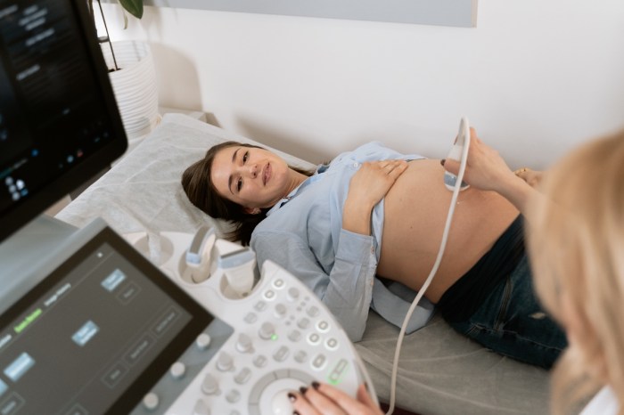 A woman undergoing an ultrasound