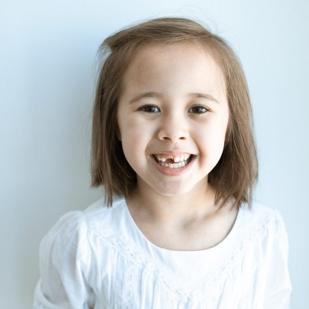 A child smiling, revealing that they are missing a tooth.