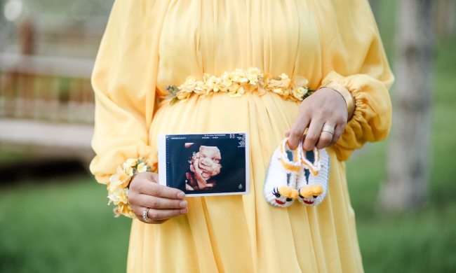 Woman in yellow dress holding 3D sonogram pregnancy announcement