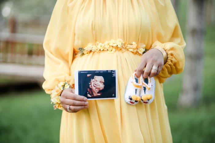 Woman in yellow dress holding 3D sonogram pregnancy announcement